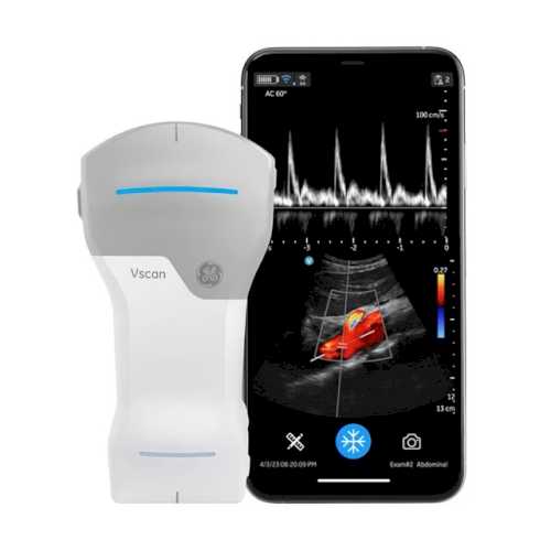GE Vscan Air™ CL Portable Ultrasound